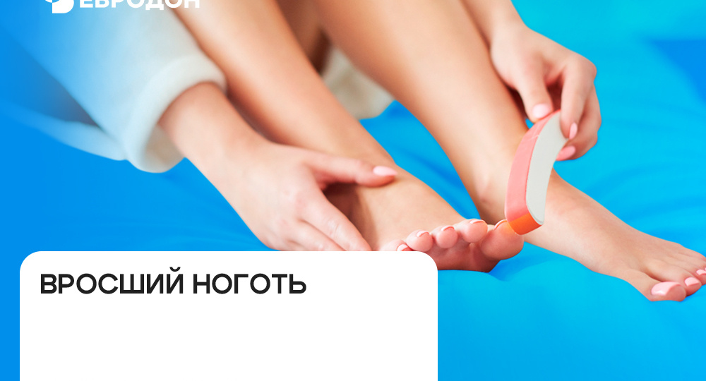 Вросший ноготь: когда нужна операция