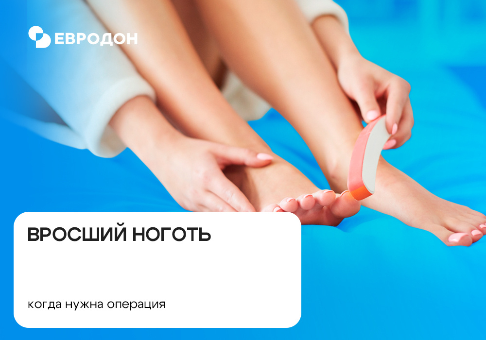 https://eurodon61.ru/about/articles/vrosshiy-nogot-kogda-nuzhna-operatsiya/