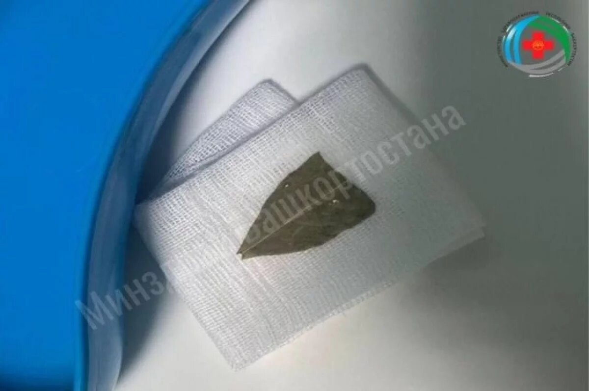    Жительница Башкирии чуть не задохнулась, проглотив лавровый лист