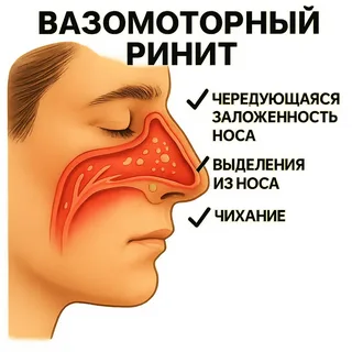 ✔️ Вазомоторный ринит: короткий чек-лист, что делать, а что нет 🤧🔥