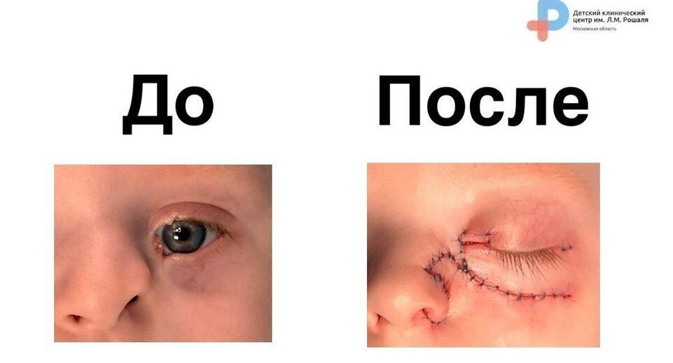    пресс-служба медцентра имени Л.М. Рошаля