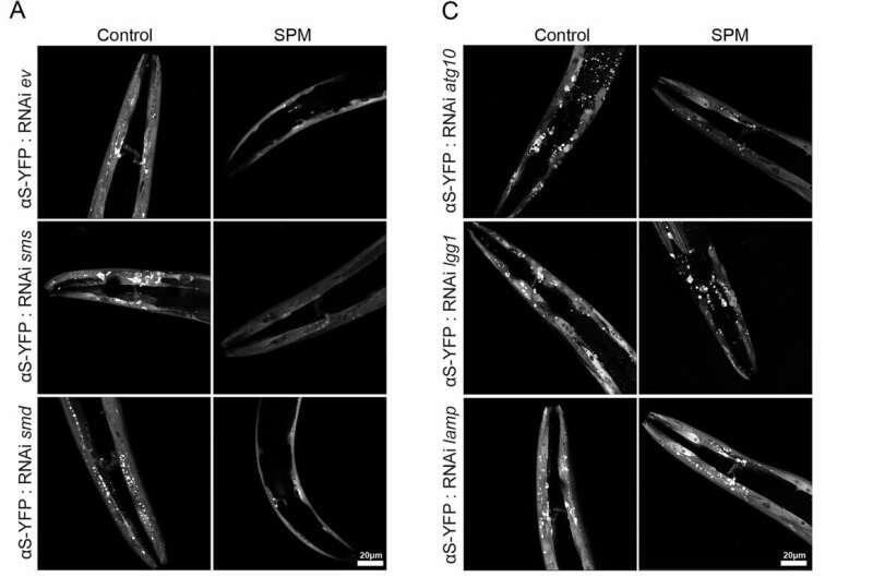 Как «сырно-макаронный» принцип может помочь в борьбе с болезнью Альцгеймера