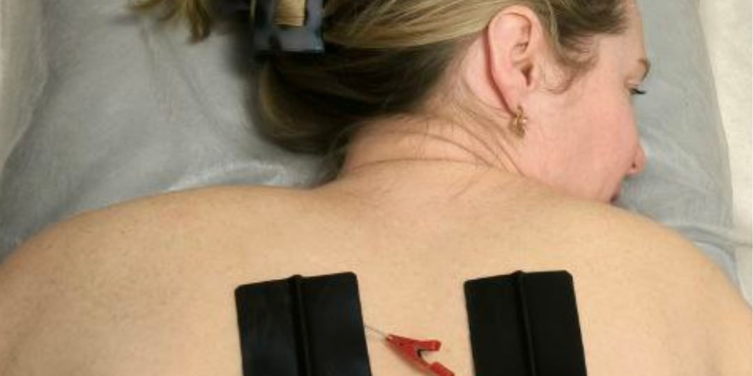 Аппаратные методы (лазер, магнит, ударно-волновая терапия, противоболевая электростимуляция) — важная часть лечения болей в спине и