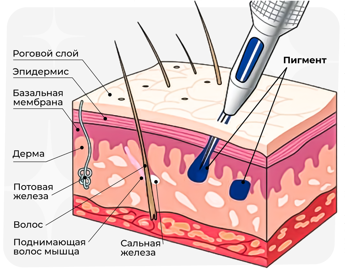 Нанесение татуировки