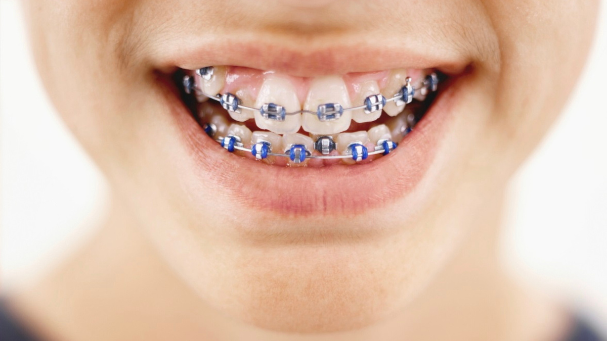 Стоматология Премоляр