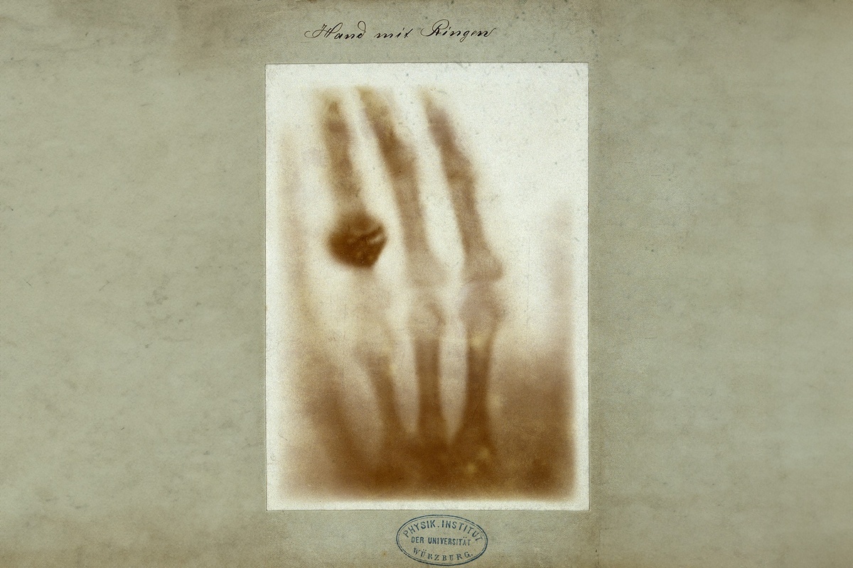    Рука с кольцами. Рентгеновский снимок кисти супруги Вильгельма Рентгена. Фото с сайта Wikipedia.org