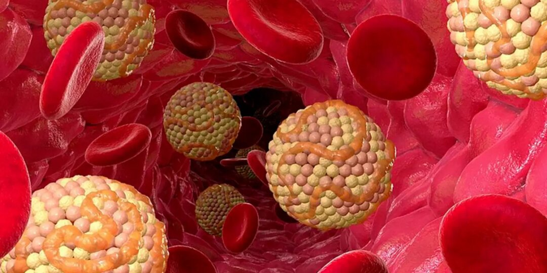 Почему холестерин «зашкаливает»: 10 скрытых причин, о которых редко говорят