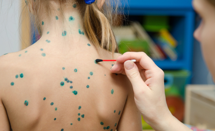 © photo credit by stock.adobe.com/ madhourse