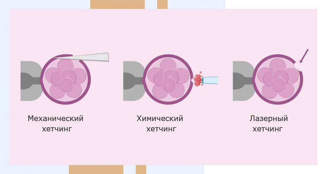 Вспомогательный хэтчинг