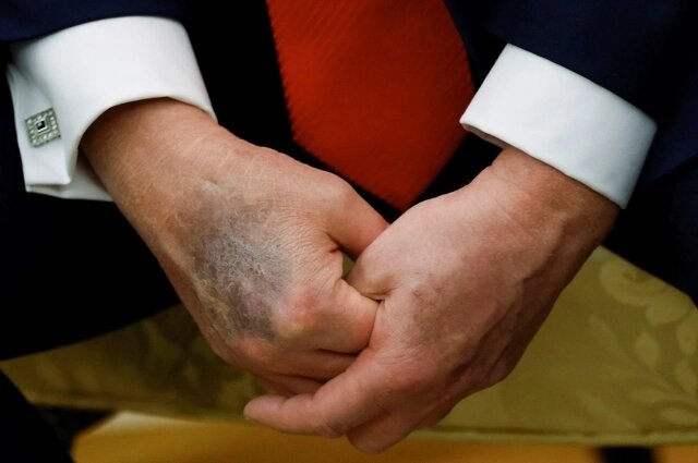    Фото: Reuters/ Brian Snyder
