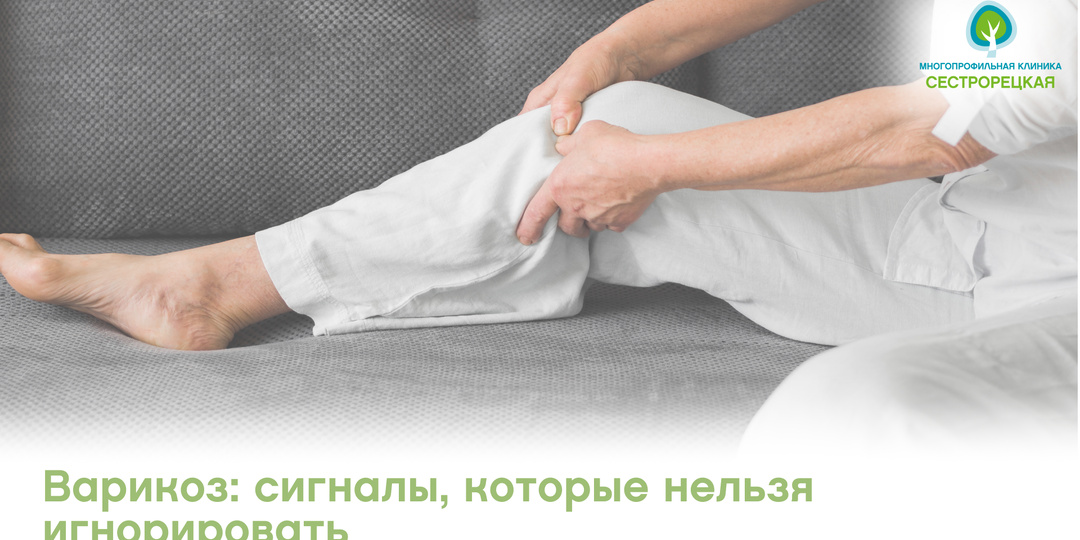 Варикоз: сигналы, которые нельзя игнорировать