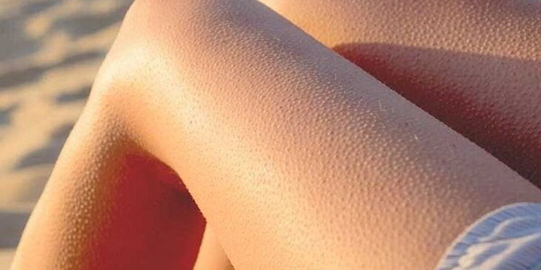 ЭТИ симптомы говорят о том, что у вас забитые сосуды! Из-за чего возникает тяжесть в ногах?