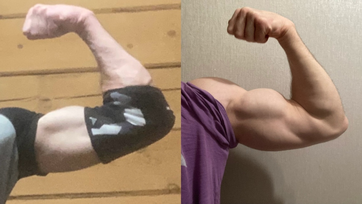 Мои руки до/после.