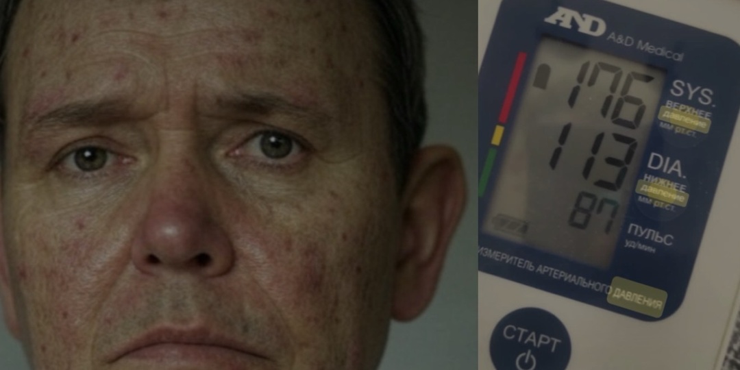 Давление начинается не с сердца: почему почки — главный регулятор вашего здоровья