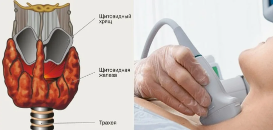 Щитовидка: ТТГ 2,5 — норма или сигнал? Почему гипотиреоз и аутоиммунный тиреоидит не замечают?