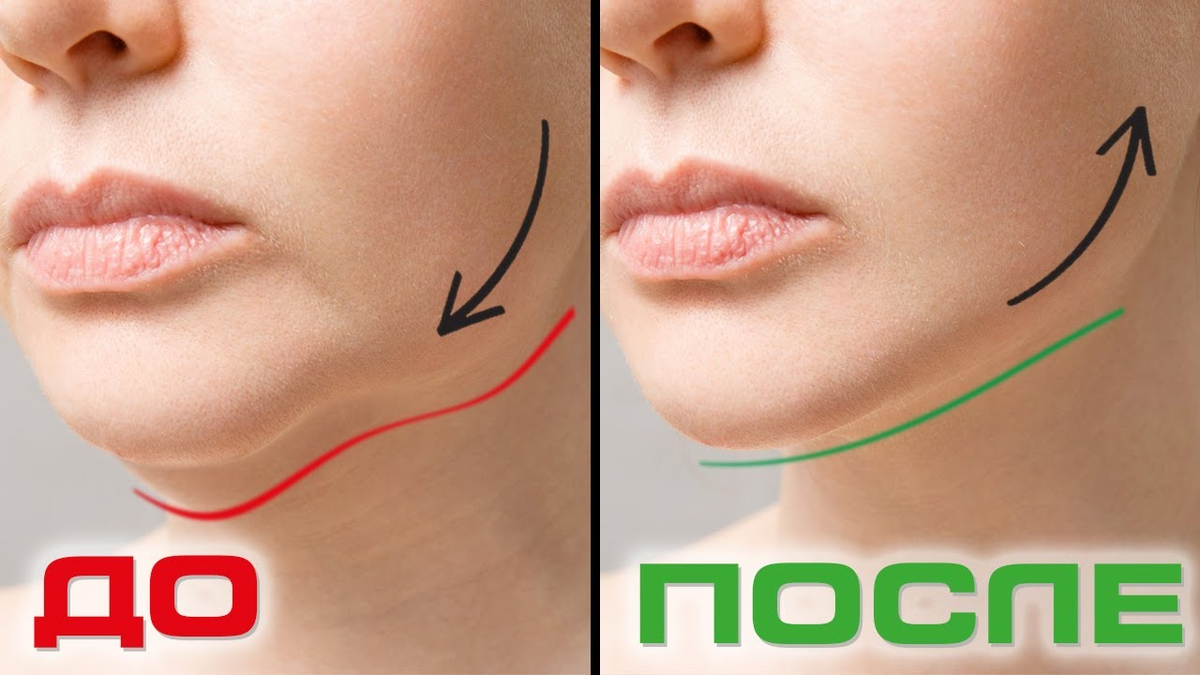 Источник: Соцсети