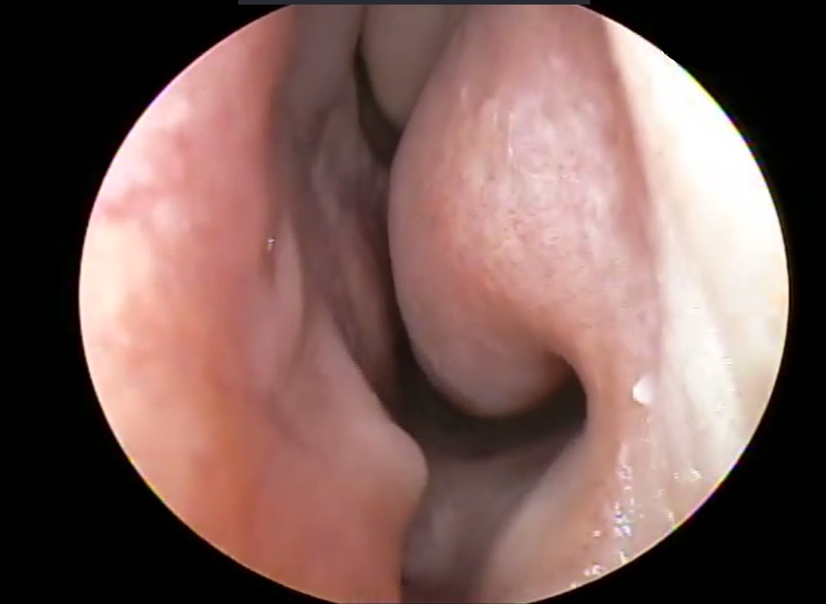 Искривлённая перегородка