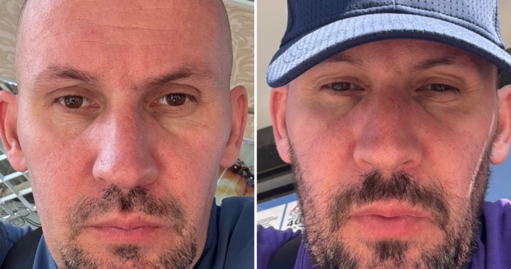 40 дней пил горячую воду и вот, что со мной стало. Делюсь с вами своими наблюдениями