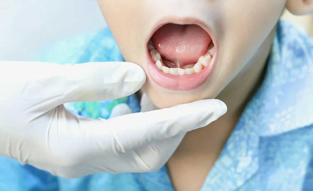 Фото из открытых источников, но у сына было очень похоже.