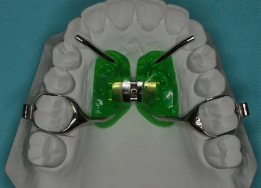 Ортодонтический образец расширителя