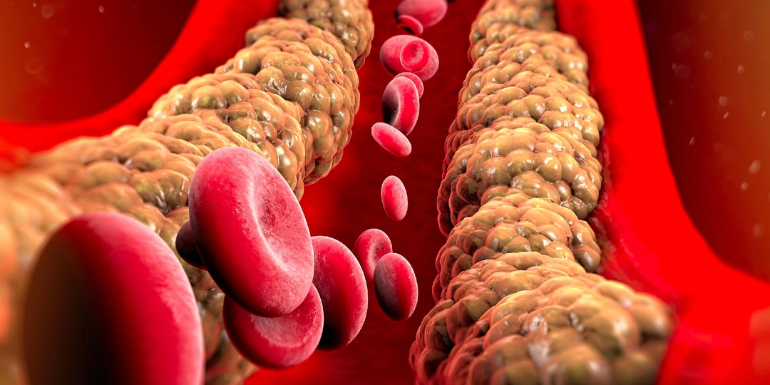 Как следить за уровнем холестерина: важные советы для здоровья