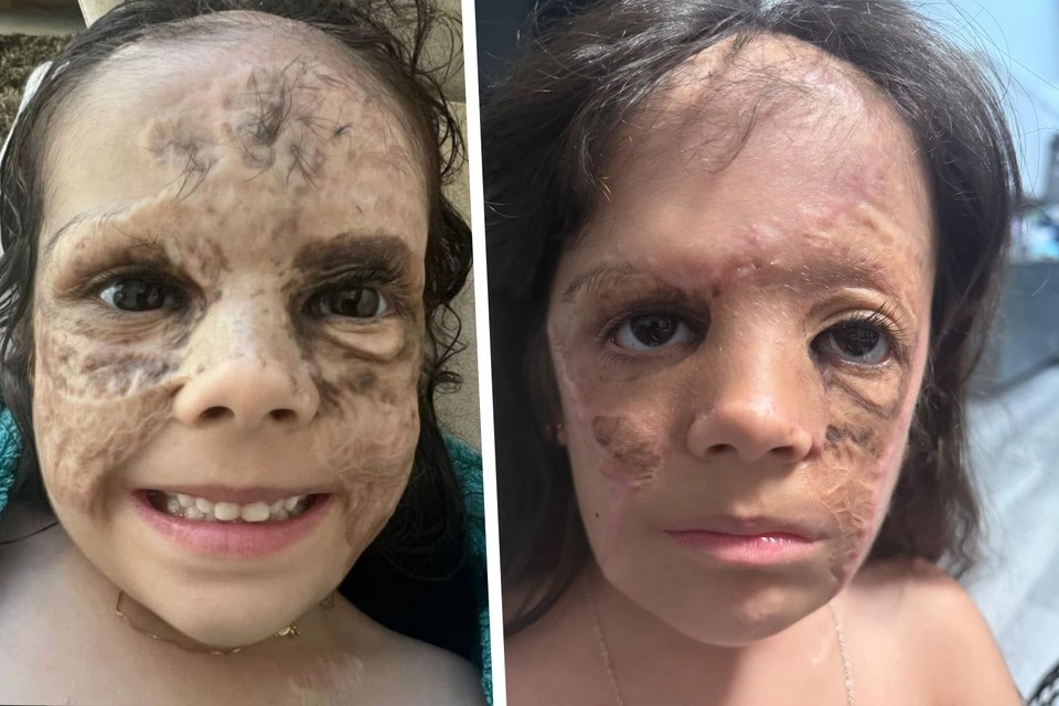    Так изменилось лицо Луны после двух этапов лечения в Северной столице. Фото: соцсети врача Ольги Филипповой. Алексей БУЛАТОВ