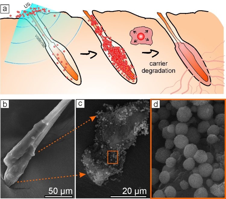 Доставка лекарств в волосяные фолликулы с помощью частиц ватерита. Фото: Ю.И. Свенская и др. / American Chemical Society / British Association of Dermatologists / Springer Nature
