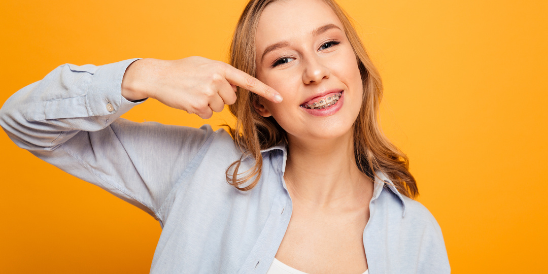 6 распространенных мифов о брекетах