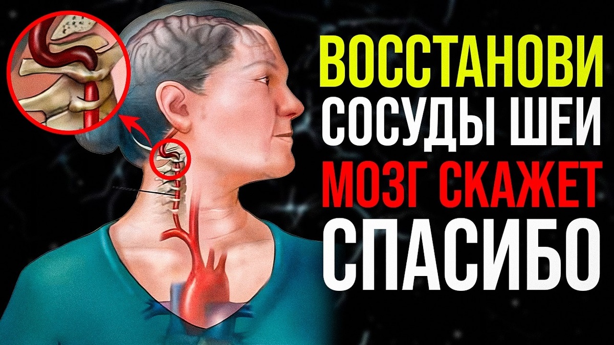 7 признаков, что сосуды шеи перестают питать мозг в полном объёме (чек-лист)