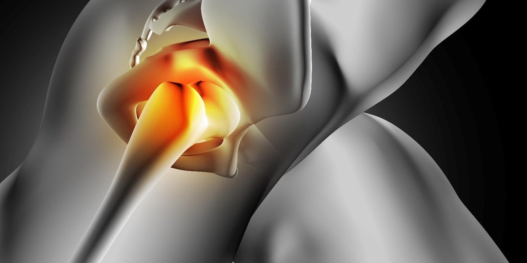 9 вещей, которые вредят тазобедренному суставу