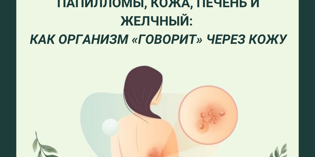 Папилломы, кожа, печень и желчный: как организм «говорит» через кожу