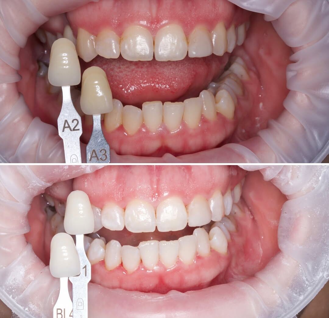 На фото- работа доктора Аманды Дадаевны