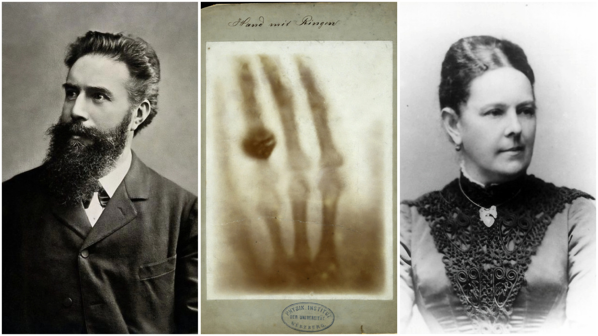 Вильгéльм Кóнрад Рентгéн, Анна Бéрта Рентгéн и кисть её левой руки