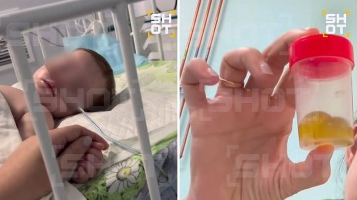 В Оренбурге 10-месячная малышка проглотила гелевые шарики и попала в реанимацию. Фото © Telegram / SHOT