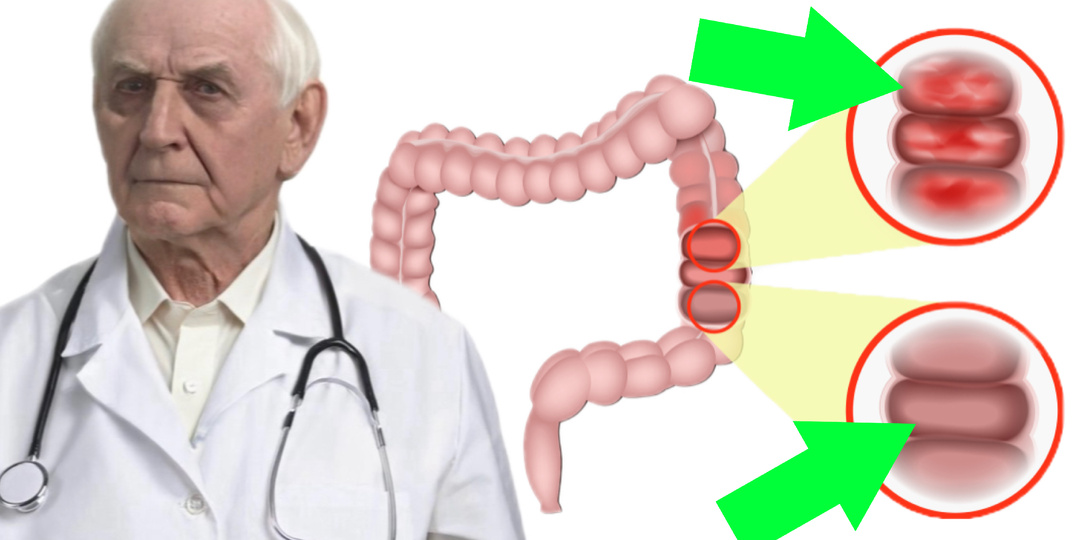 Боль в кишечнике: как отличить «опасную» по мнению врачей