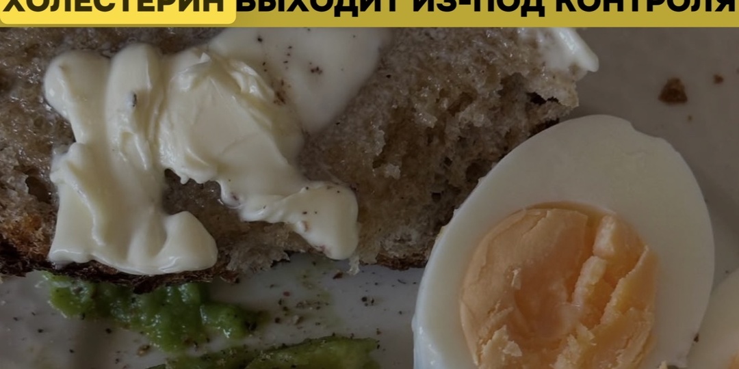 Холестерин: 10 малоизвестных причин дисбаланса по мнению эндокринологов