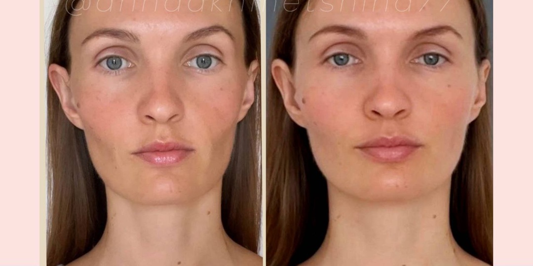 РЕЗУЛЬТАТ ИРИНЫ🎀