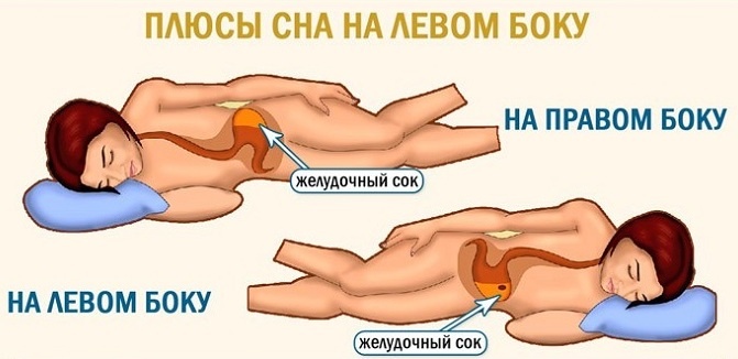 -4
