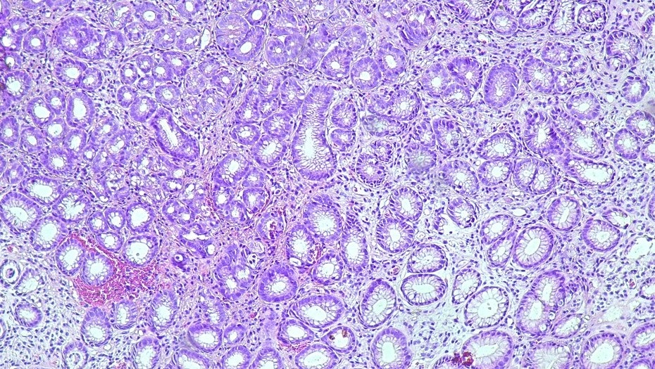    Автор фото: Didin Muh Hasyir/Shutterstock/FOTODOM