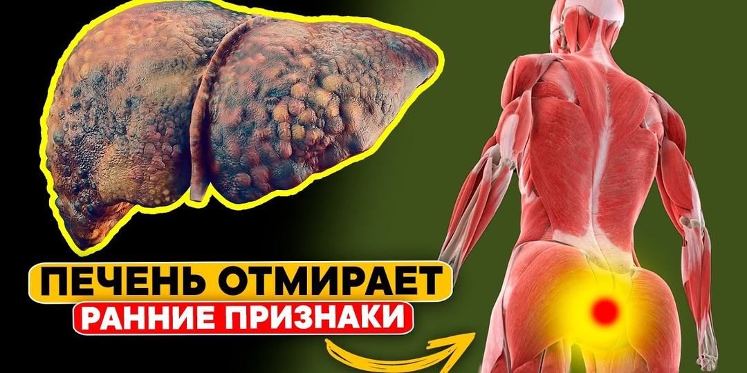 5 признаков, что печень начала терять способность очищать кровь (чек-лист)