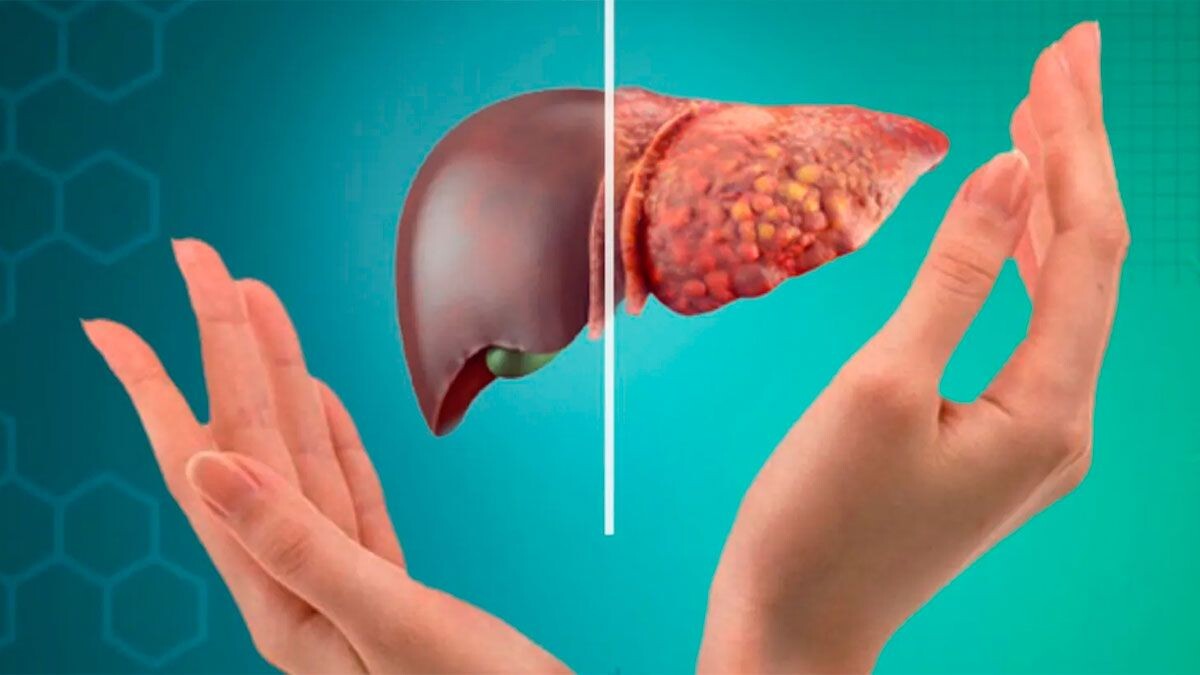 Думала, что это аллергия, а анализы показали тяжёлые изменения печени (моя история)