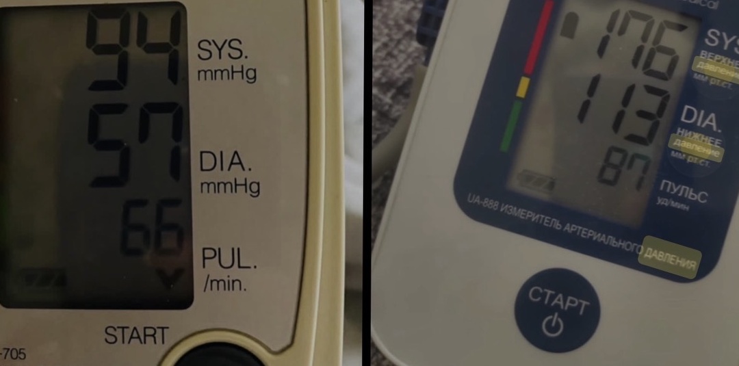 Диастолическое давление: почему нижняя цифра на тонометре опаснее, чем кажется