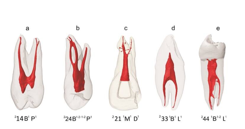 Под буквой С (посередине) - встречающееся строение центрального (как мы думаем, самого простого однокоренного зуба)