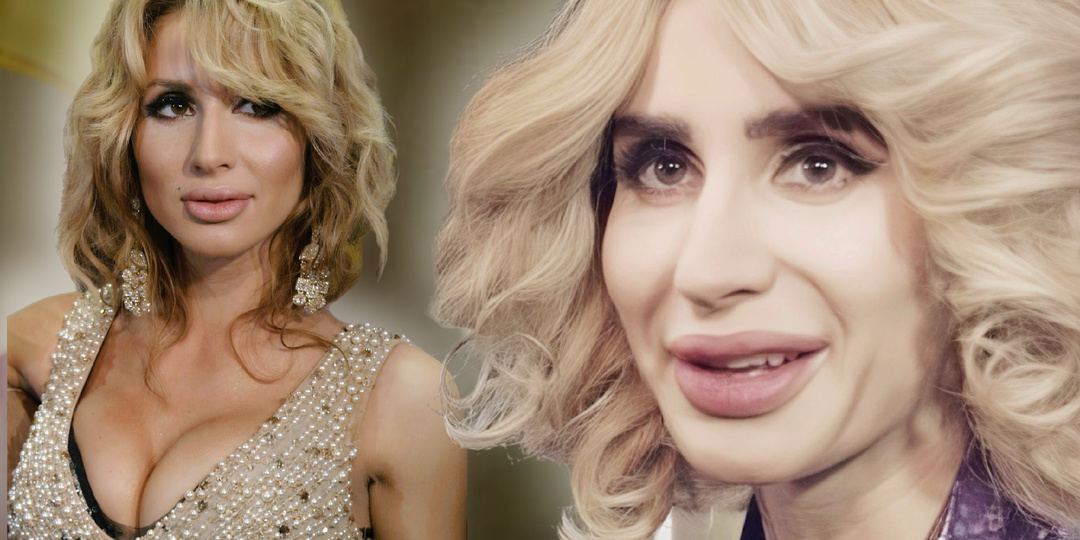 "Губы как камень, глаза как у бабушки": хирург разобрал лицо Лободы и ужаснулся - раньше мужики "теряли голову" от нее, а теперь не узнают