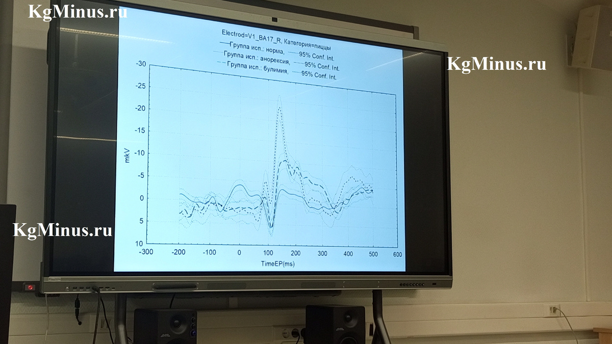 Группа нормы (здоровые люди, т.е. без диагноза РПП) - сплошная линия.