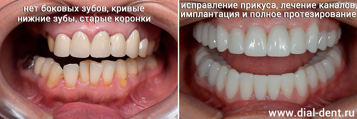 комплексный подход к улучшению эстетики и стоматологического здоровья
