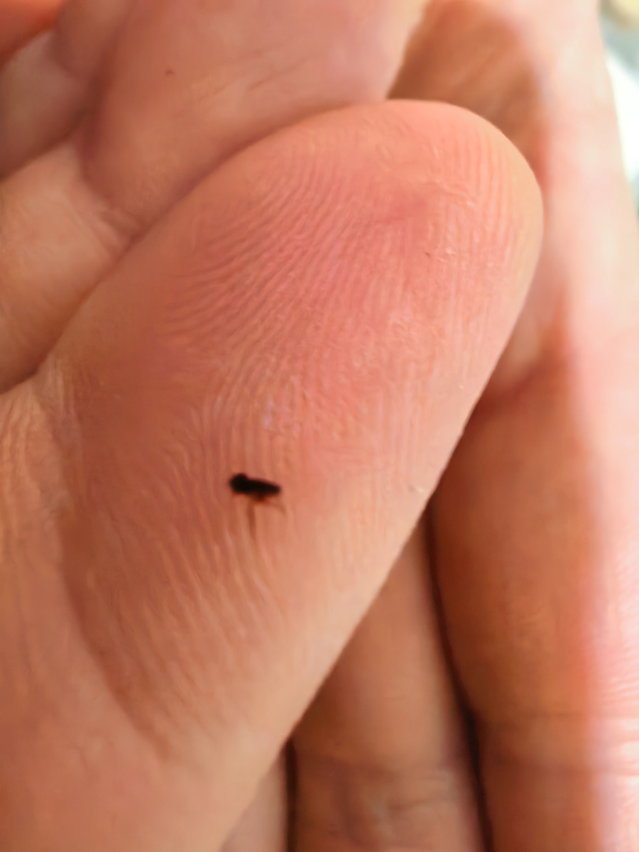 Земляная блоха