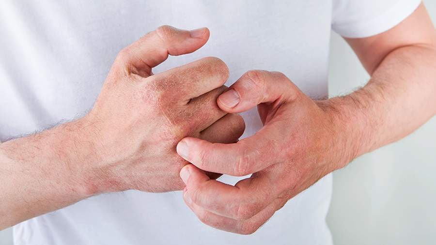 🔥 ЧТО СКРЫВАЕТ ВАША КОЖА? 🔥 Или почему псориаз, экзема и дерматиты — это НЕ БОЛЕЗНИ кожи?