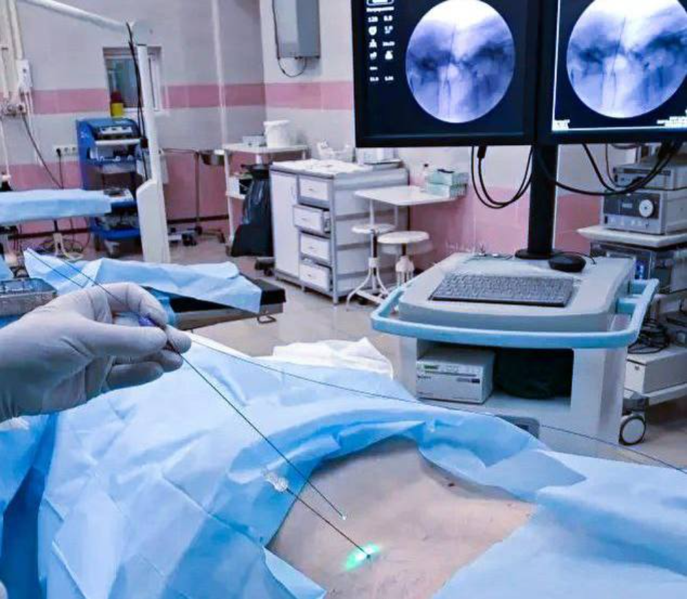    Операцию проводят через крошечный прокол на коже и под контролем рентгена