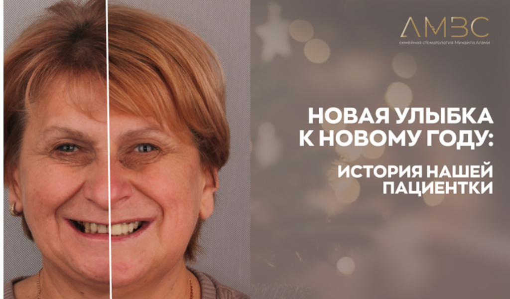 Новая улыбка с постоянными зубами за несколько визитов